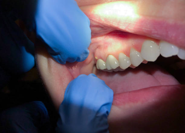 Best Weekend Emergency Dentist in Lone Grove, OK
