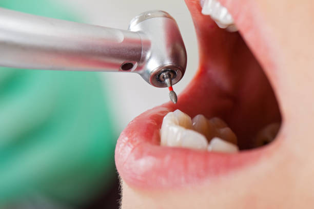 Best Pediatric Emergency Dentist in Lone Grove, OK